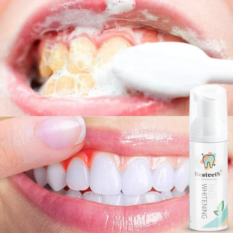 Teeth Whitening Mousse Tooth Cleaning White Teeth Oral Hygiene Dental Tool Bleaching Remove Stains Toothpaste Foam