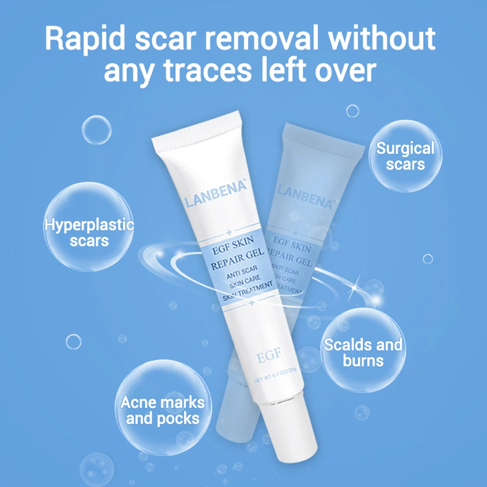 

Acne Scar Removal Cream Pimples Stretch Marks Face Gel Remove Acne Smoothing Whitening Moisturizing Body Skin Care Aichun ship