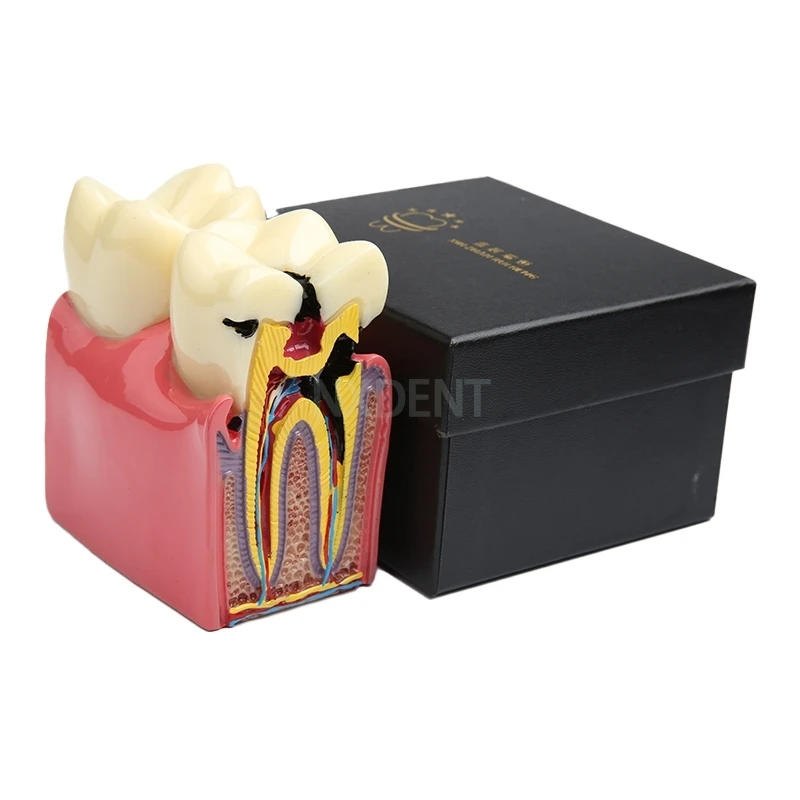 1 шт. карниз для зубов | Красота и здоровье