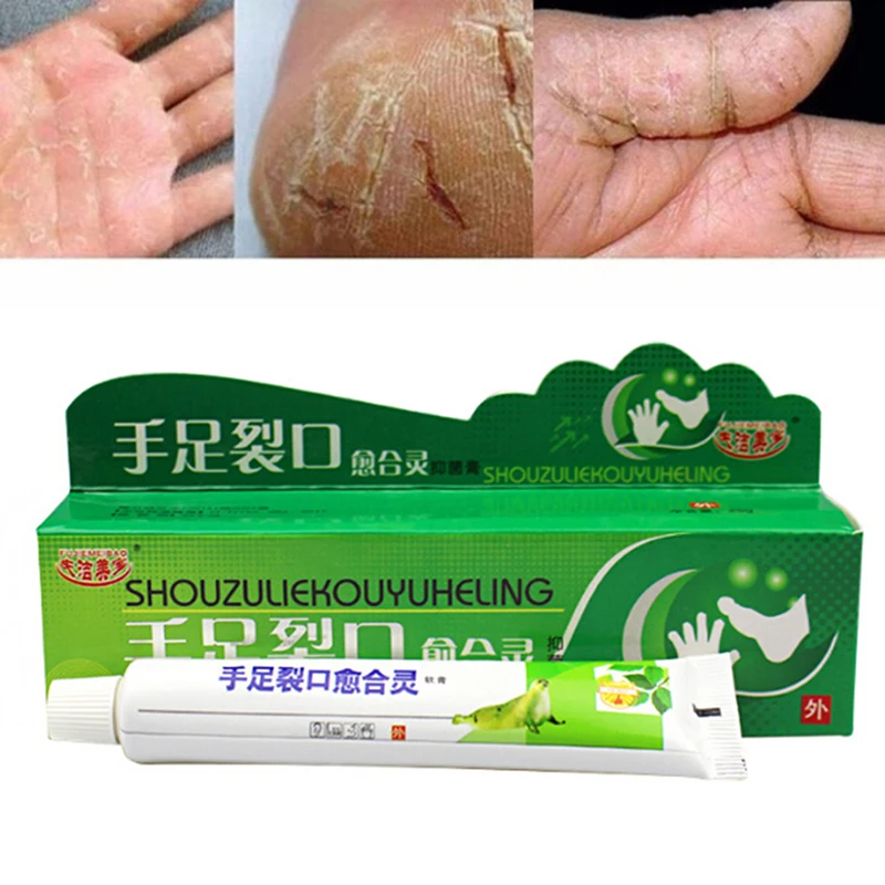 

25g Effective Powerful Hand Foot Crack Cream Heel Chapped Peeling Foot And Hand Repair Anti Dry Crack Skin Care Chinese Ointment