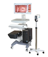 digital video vagina colposcope for gynecology