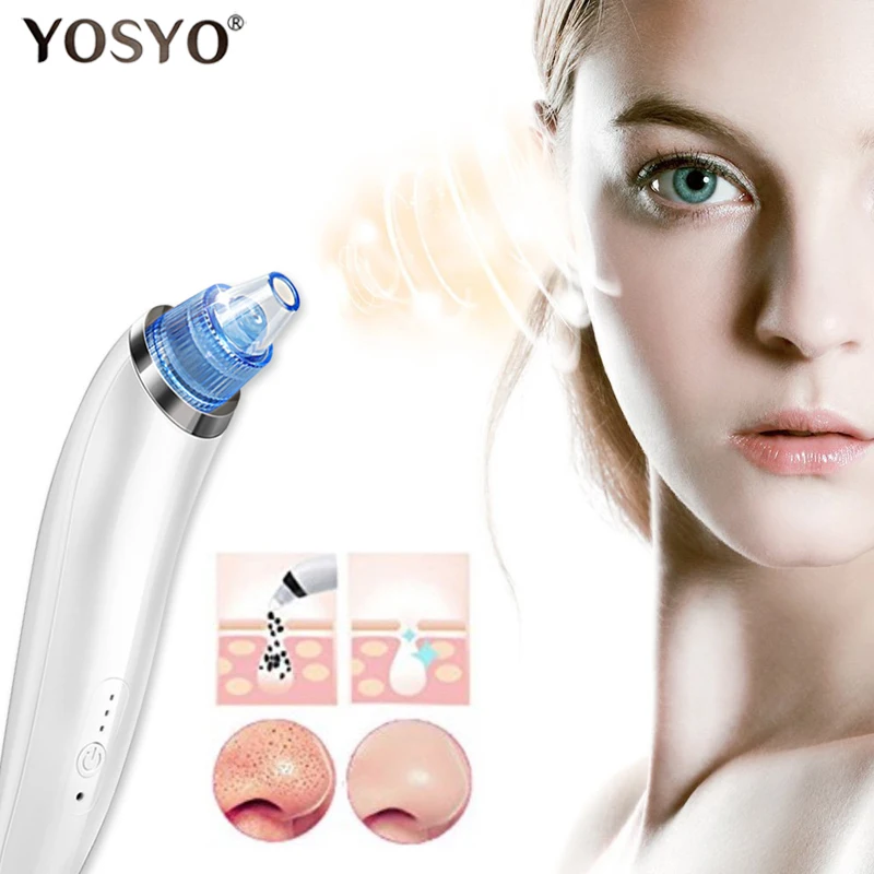 Электрический аппарат для удаления черных точек Мини Ручной вакуумный подтяжки