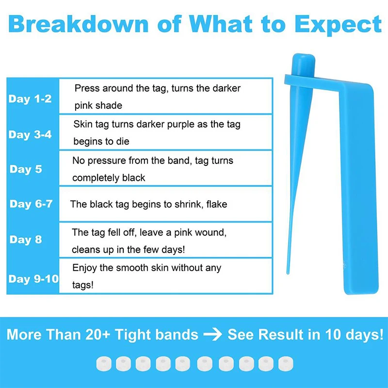 Кожа Машинка для удаления магнитных бирок удалить бородавки средство акне уход