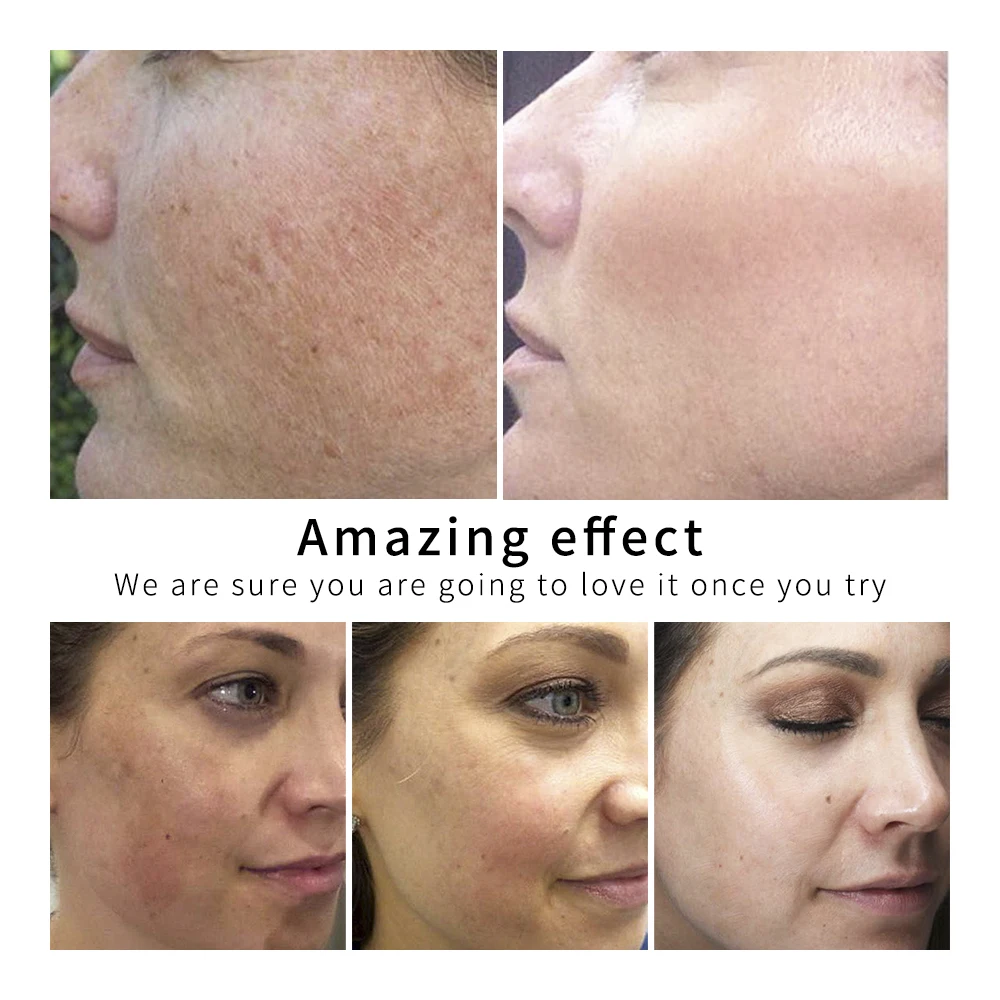 

LANBENA Gold Silk Collagen Ampoule Serum Removes Melanin Lighten Dark Spots Whitening Firming Flexible Anti Aging Anti Wrinkle