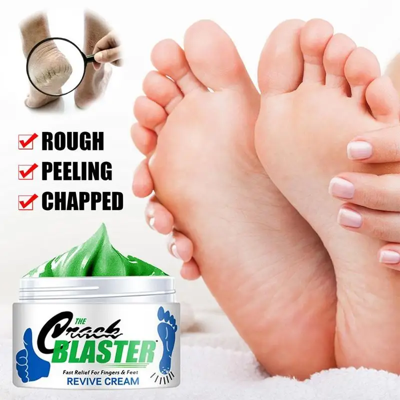 

0G Hand and Foot Chapped Cream Foot Blister Peeling Scar Bad Foot Cream