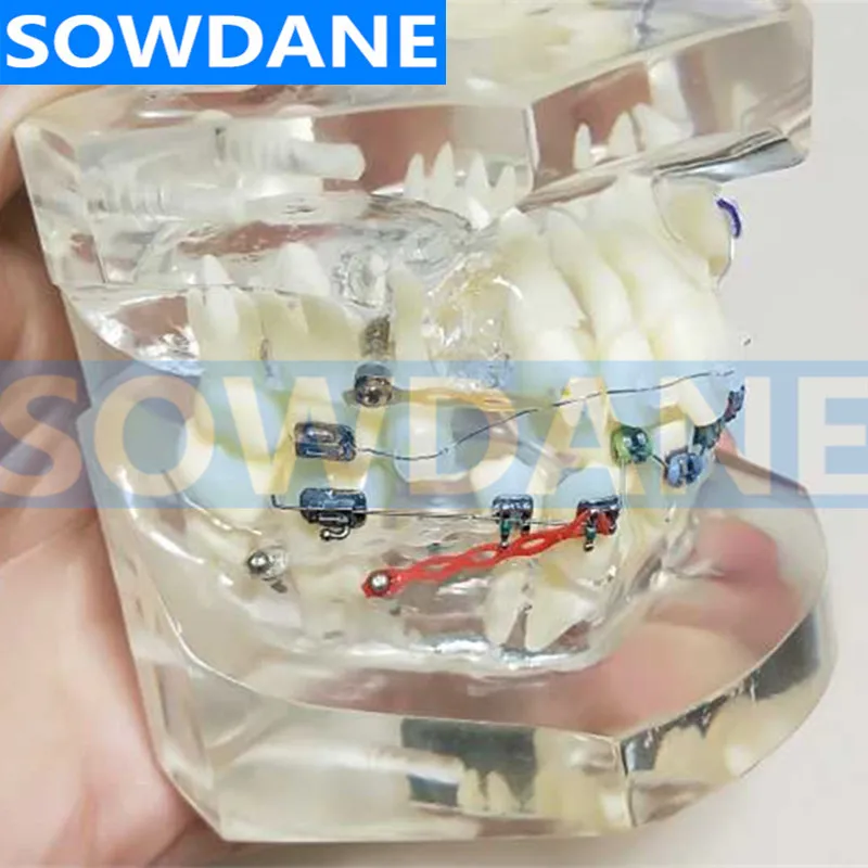 Прозрачная Стоматологическая Ортодонтическая модель для прикуса с двумя видами