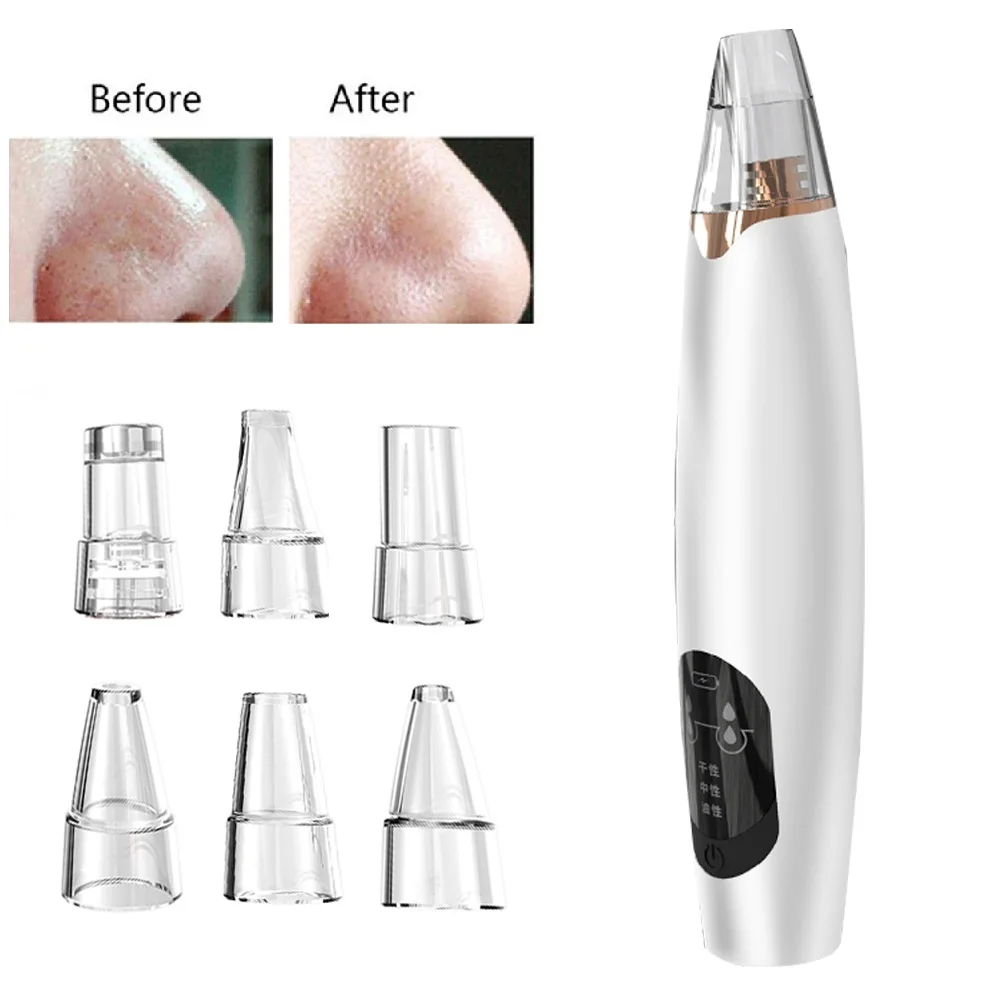 Устройство для удаления черных точек устройство глубокого огрубевшей