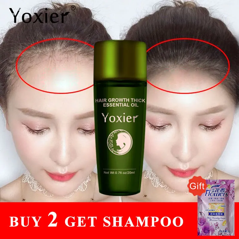 Эффективный быстрорастущий Сыворотка для ухода за волосами увлажняющий против