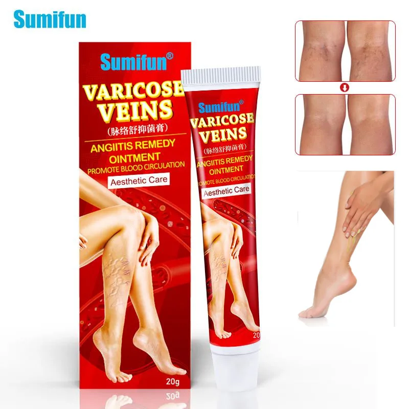 

Sumifun 1Pcs Varicose Veins Treatment Cream 100% Original Vasculitis Phlebitis Spider Pain Relief Ointment Medical Plaster P1149