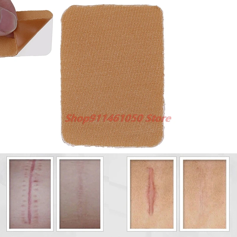 

New Reusable Silicone Gel Scars Away Patch Removal Cesarean Scar Treatment Potent Removal Scar Therapy Sheet Skin 3.5*5cm