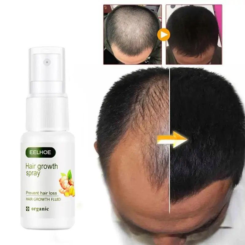 Имбирная Сыворотка для роста волос 20 мл против выпадения Alopecia жидкость