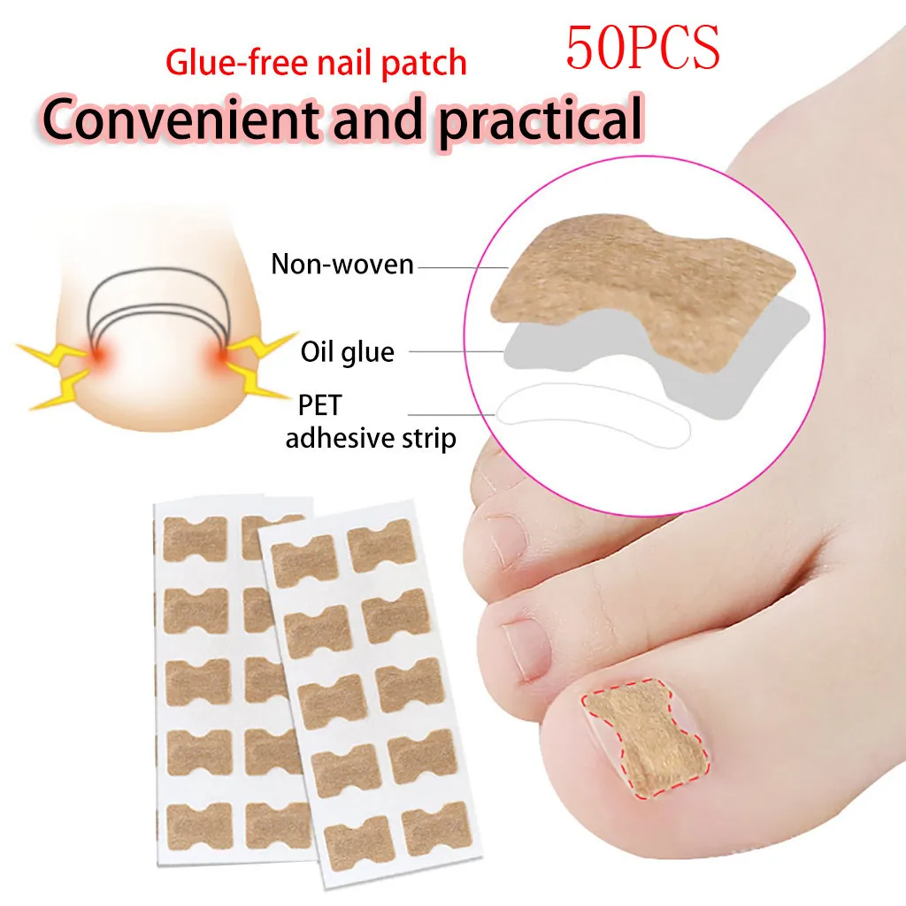 Корректор для вросших ногтей корректор ухода за ногтями педикюра|Инструмент