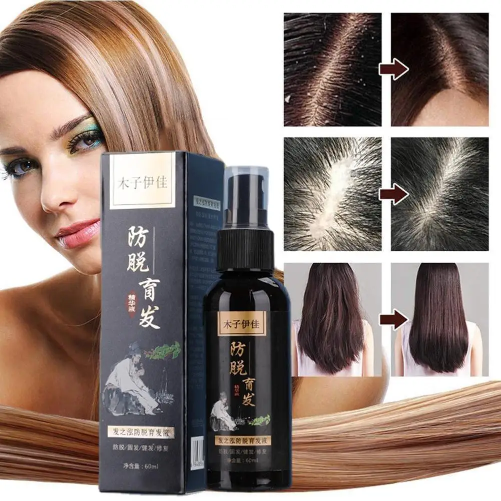 

Hair Growth Shampoo And Ginseng Ginger Hair Growth Oil Hair Treatment Products Prevent Hair Loss Hair Growth Oil Hair Care