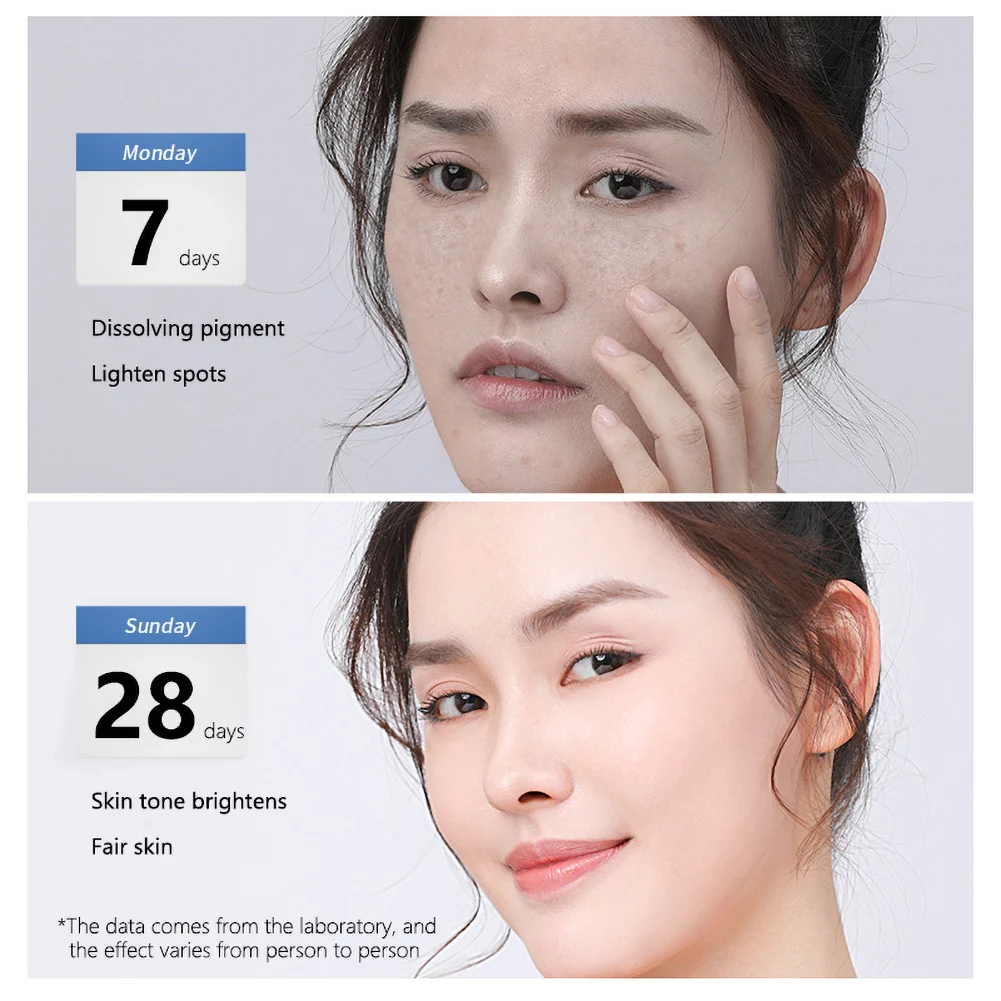 

Anti Wrinkle Aging Remover Cream Whitening Dilute Spot Melanin Acid Moisturizer Face Cream For Female