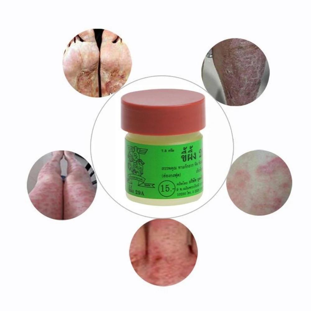 

5/10Pcs 29A Antipruritic Eczema Psoriasis Cream and Dermatitis Thailand Traditional Therapy Ointments Antibacterial Body Cream