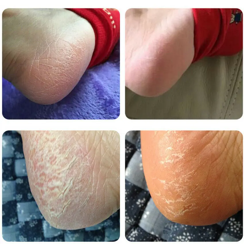 20 г зимняя ремонта вручную парк Спрингс увлажняющий крем анти обветривания