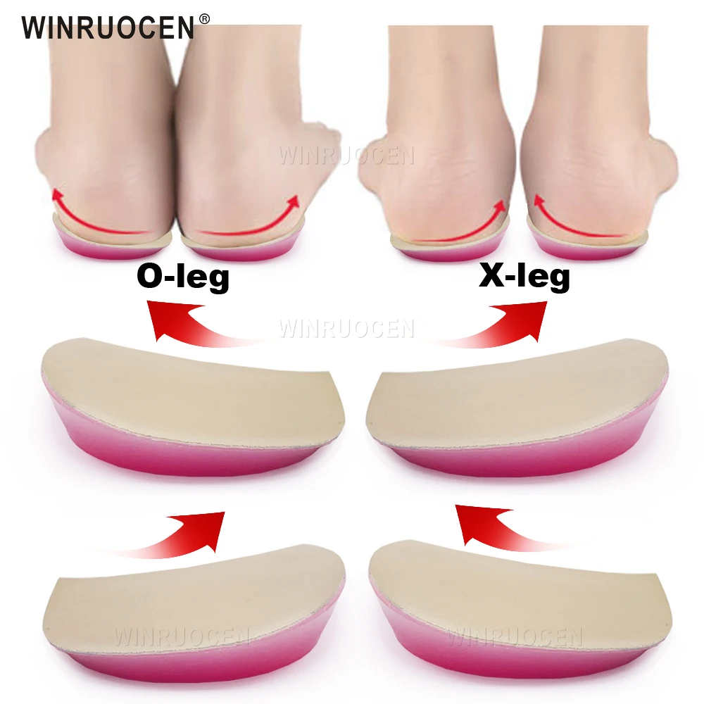 

WINRUOCEN X/O-type Legs Orthopedic Insoles Silicone Corrector Gel Shoe Inserts For Heel Knee Pain Bow Legs Valgus Varus Pad