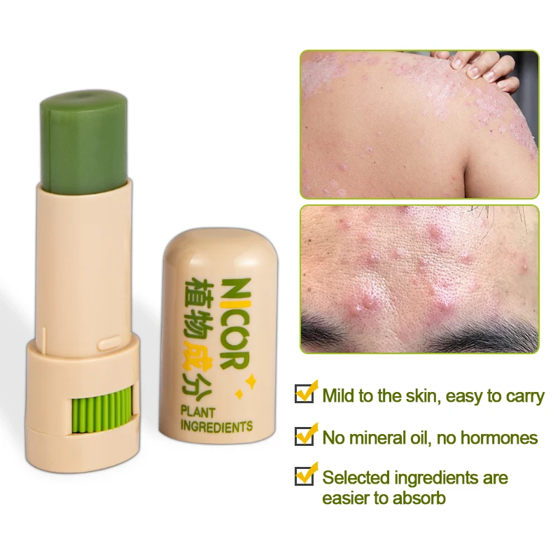 Антизудный пластырь 7 грамм Палочка мятного аромата с растительными экстрактами китайской медицины, увлажняющий, охлаждающий, успокаивающий укусы комаров и облегчающий зуд.