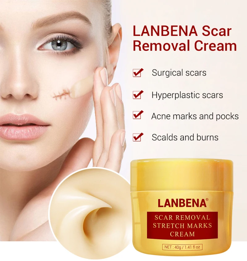 

LANBENA 30g Acne Scar Removal Cream Pimples Stretch Mark Face Gel Remove Acne Smooth Whitening Moisturizing Body Skin Care TSLM1