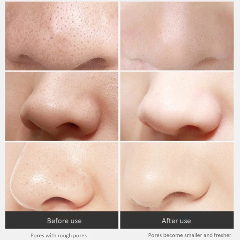 

Control Oil Shrinking Pores Facial Cleansing Brush Electric Silicone Cleansing Instrument Massager Soft Face Wash