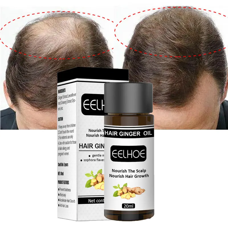 

Имбирные товары, средство против выпадения волос, сыворотка для сухих и волнистых волос, истончение кожи головы, уход за волосами 20 мл