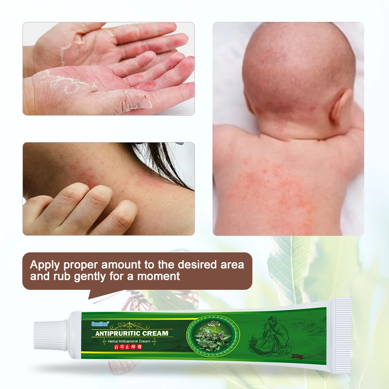 

2021 New Treatment Psoriasis Cream Eczema Ointment Anti Itching Dermatitis Chinese Plaster Pain Anti-itch Medical Plaster