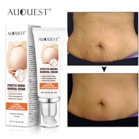 auquest maternity cream stretch marks remove for pregnant women treatment skin care maternity pregnancy scars body cream 45g