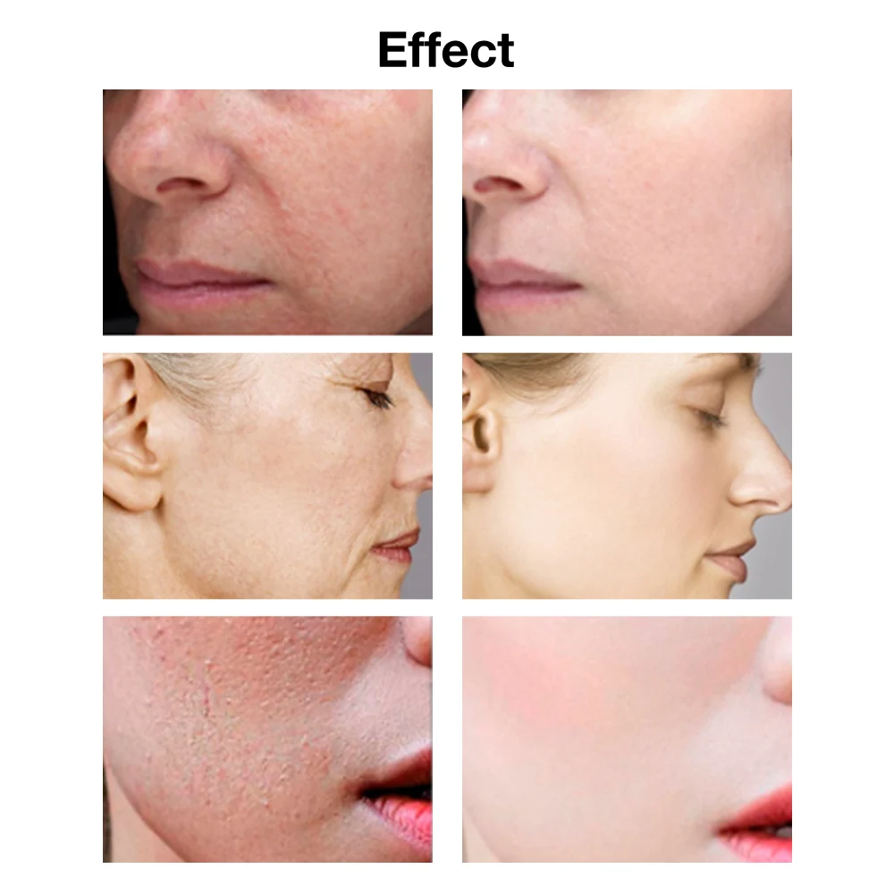 Увлажняющий крем для лица 38 г против старения сухой кожи увлажняющий нежный