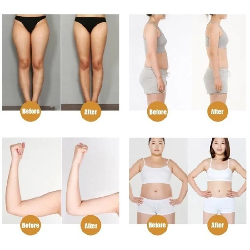 Сжигание жира наборы туалетных принадлежностей 10 шт. пластырь для похудания