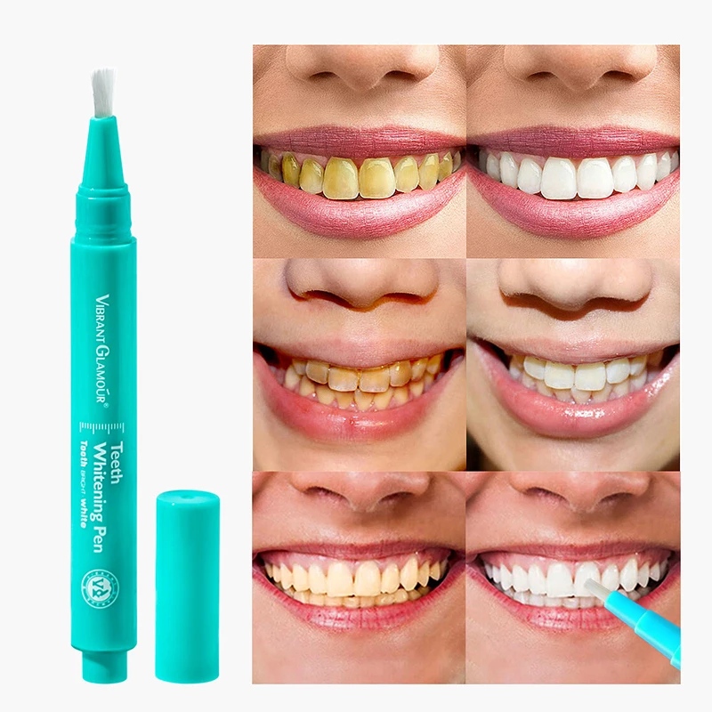 

Teeth Whitening Pen Remove Tartar Clean Dental Tool Remove Yellow Tooth Stains Solid Tooth Care Gel