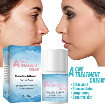 30ml Herbal Tea Tree Acne Treatment Face Serum Prons Reduce Repair Benzoyl Peroxide 10% Sensetive Skin Care Beauty Health 5