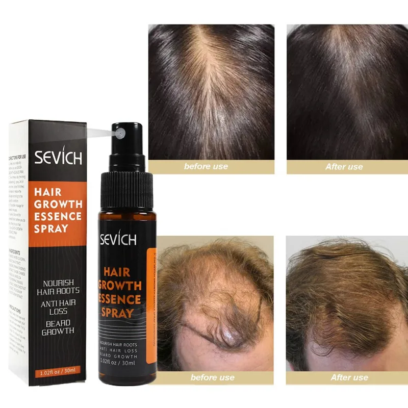 Effective Hair Growth Essence Spray Nourishing Scalp Enhance Tenacity Anti-Hair Loss Serum | Красота и здоровье