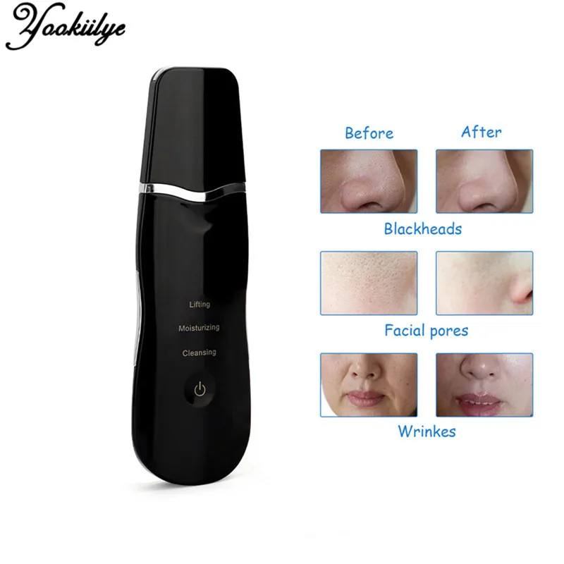 

Ultrasonic Ion Facial Deep Cleaner Blackhead Acne Remover Facial Exfoliator Skin Scrubber Peeling Shovel Pore Cleaning Device