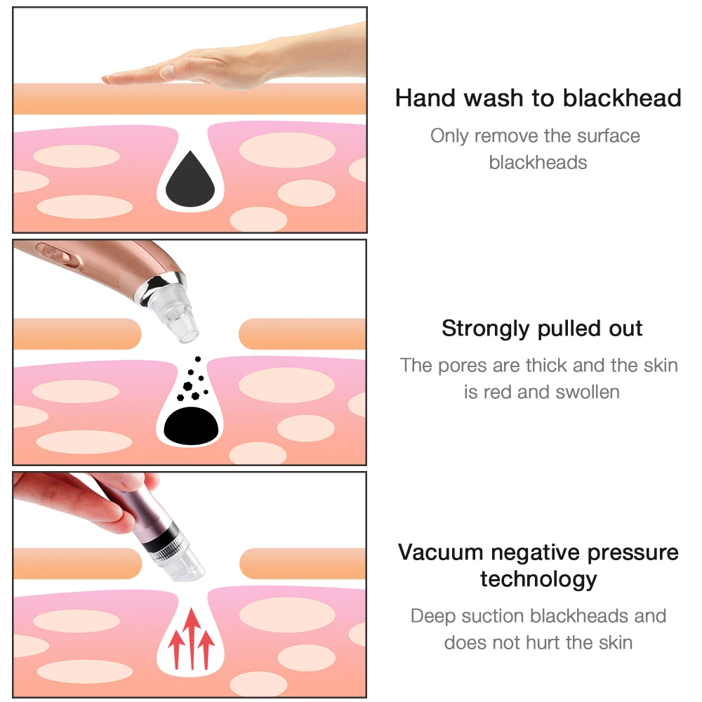 Спрей для воды Foreverlily Hydro Jet Beauty Machine Удаление угрей прыщи пылесос вакуумный отсос