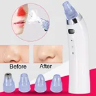 2018 очиститель пор для лица, средство для удаления черных точек, вакуумный аппарат для удаления черных точек, алмазной дермабразии, косметическая машина для очистки лица