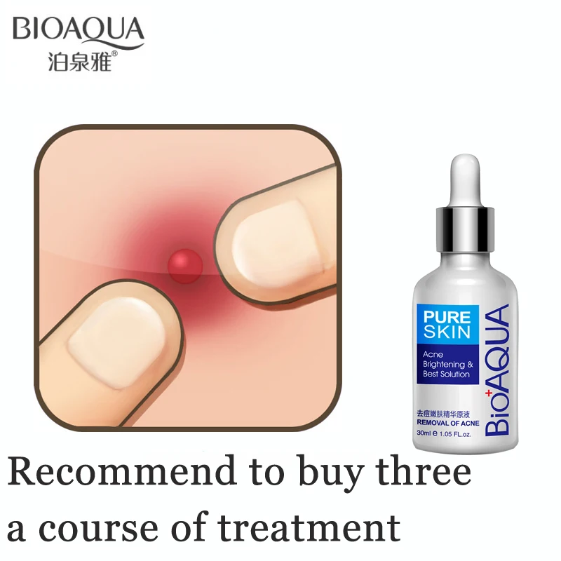 Бренд BIOAQUA 30 мл лечение акне субстанция от угревой сыпи удаление шрамов пятна