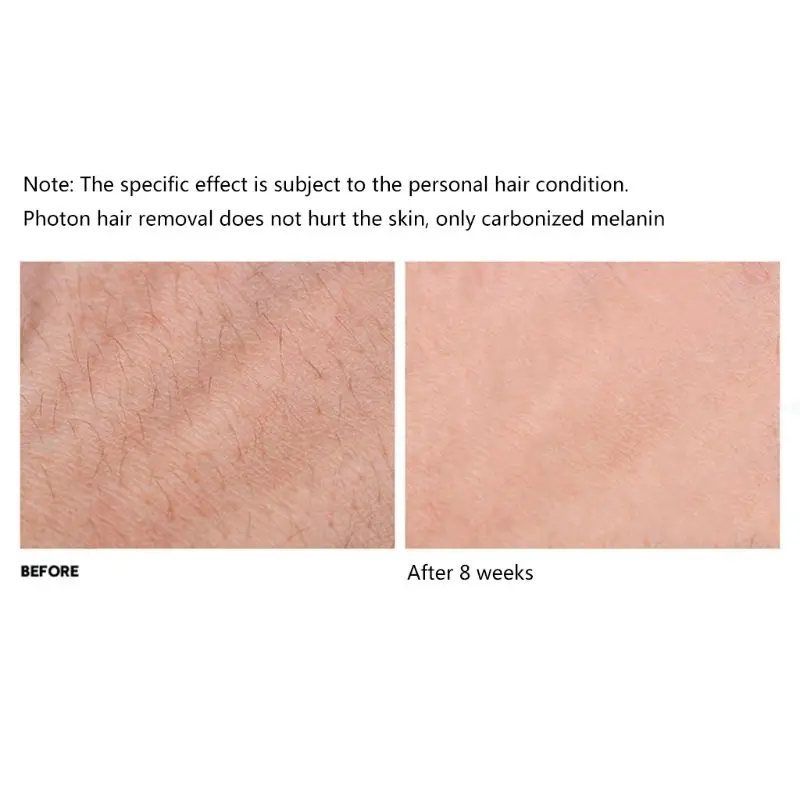 

300000 flash professional permanent IPL epilator hair removal electric photo women painless threading hair remover 094E