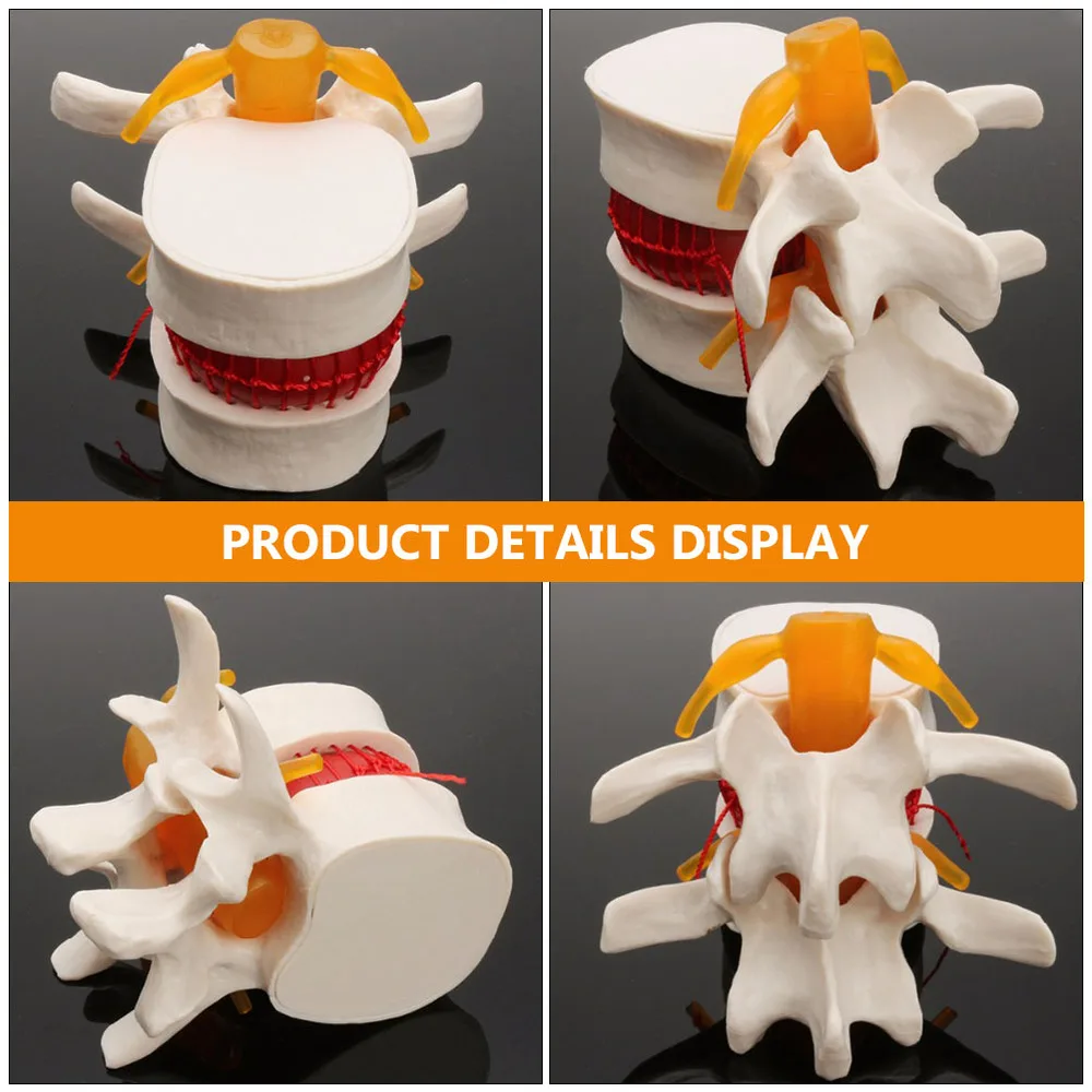

1pc Human Spine Model Lumbar Disc Herniation Presentation Model for School