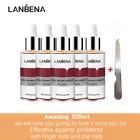 Эссенция для ухода за ногтями, восстановление ногтей от грибка, удаление онихомикоза пальцев ног, уход за кожей рук и ног атлета, 5 шт.