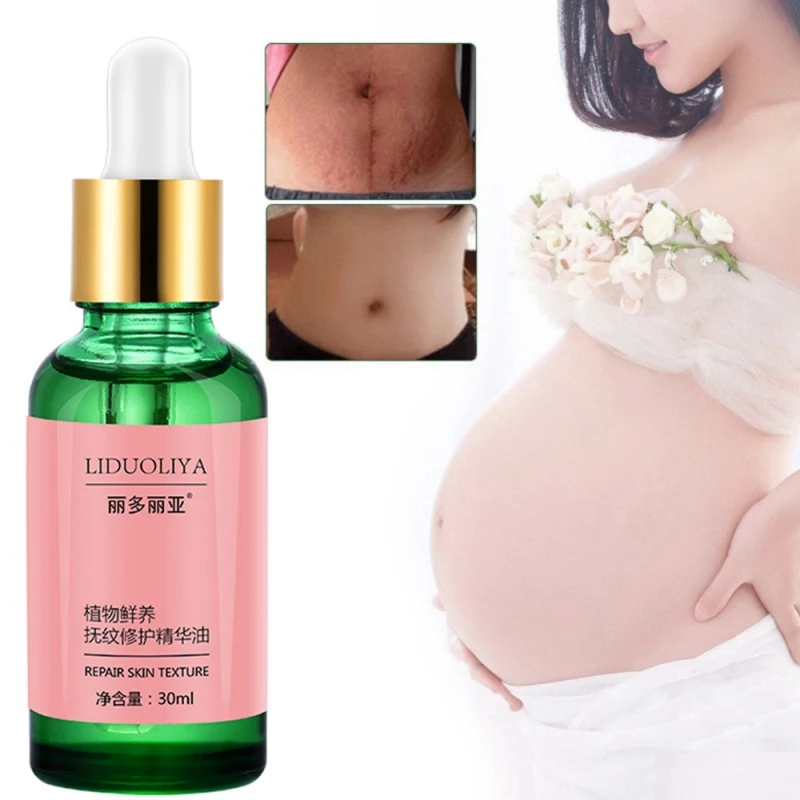 Чистое Натуральное удаление растяжек эфирные масла растяжки для удаления