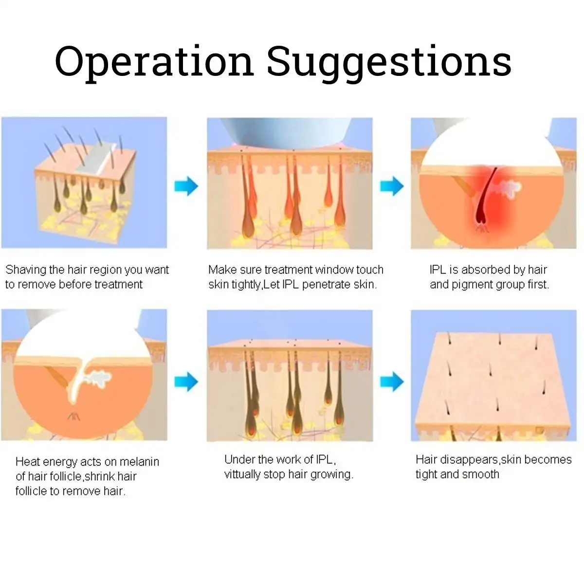 

999999 flash IPL laser hair removal machine laser epilator hair removal Device permanent bikini trimmer depilador a laser women