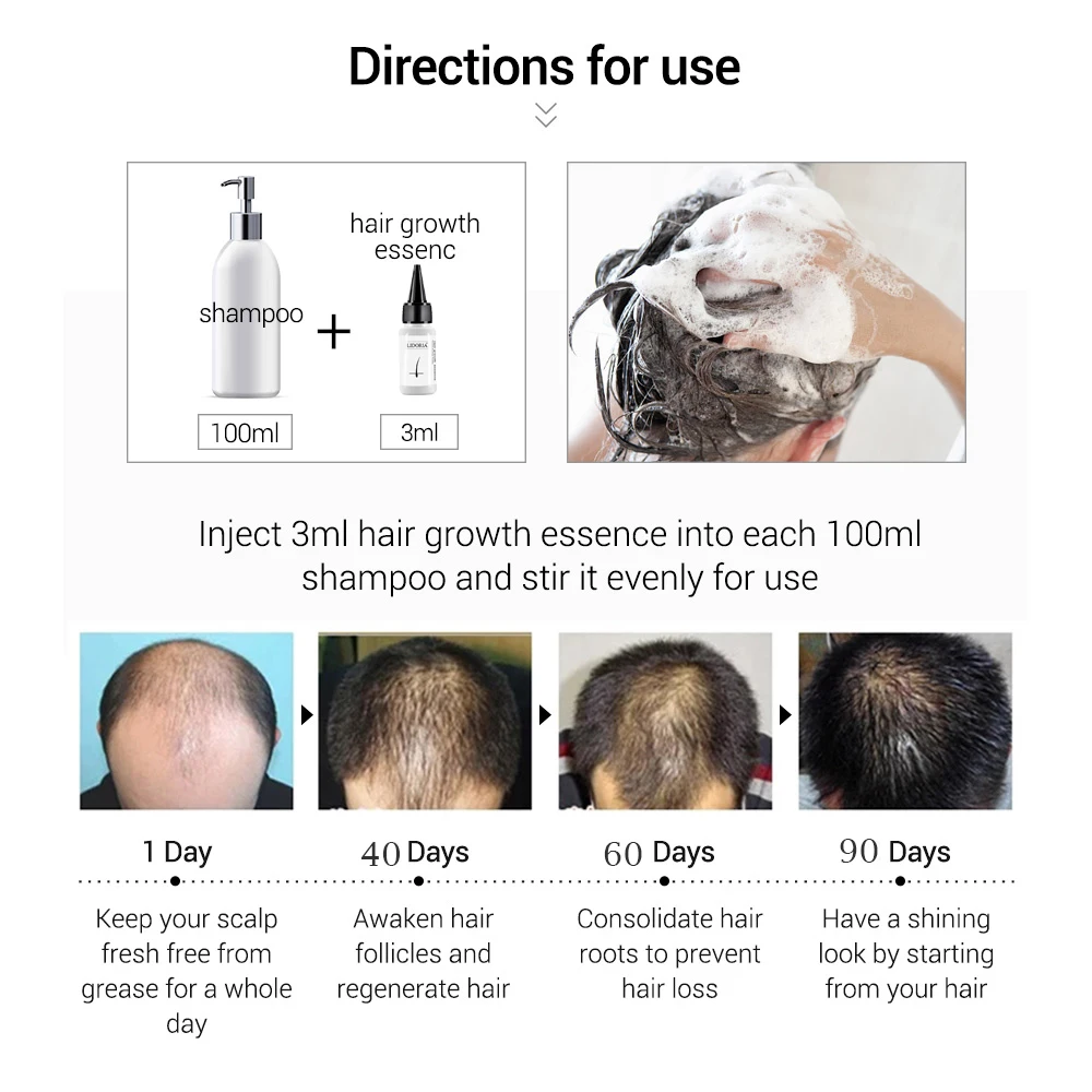 

Hair Loss Goods Natural with No Side Effects Grow Hair Faster Regrowth Hair Eye Lashes Serum Mascara Lengthening Eyebrow Growth