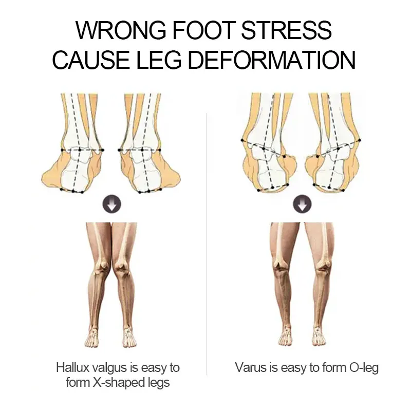 Силиконовые ортопедические стельки с O-образным корректором ступней для мужчин и