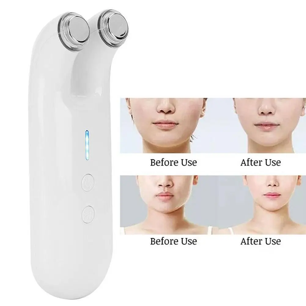 

Rechargable Micro Electricity Imported Beauty Apparatus Care Device Anti Beauty Anti-aging Vibration Facial Wrinkle Eye A0W8