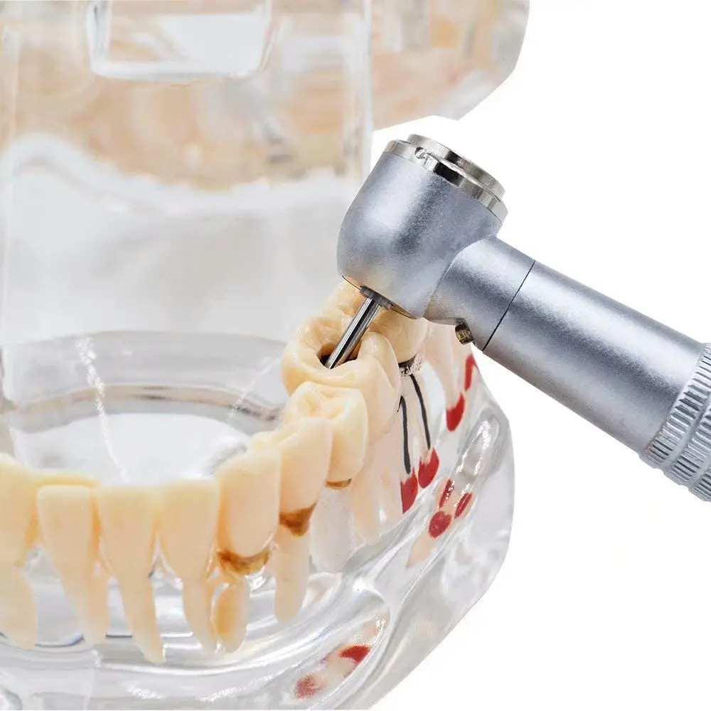 

Dental Handpiece High Velocity Rotation LED Lab Cleaning Supply 2H 2pcs Oral Kit