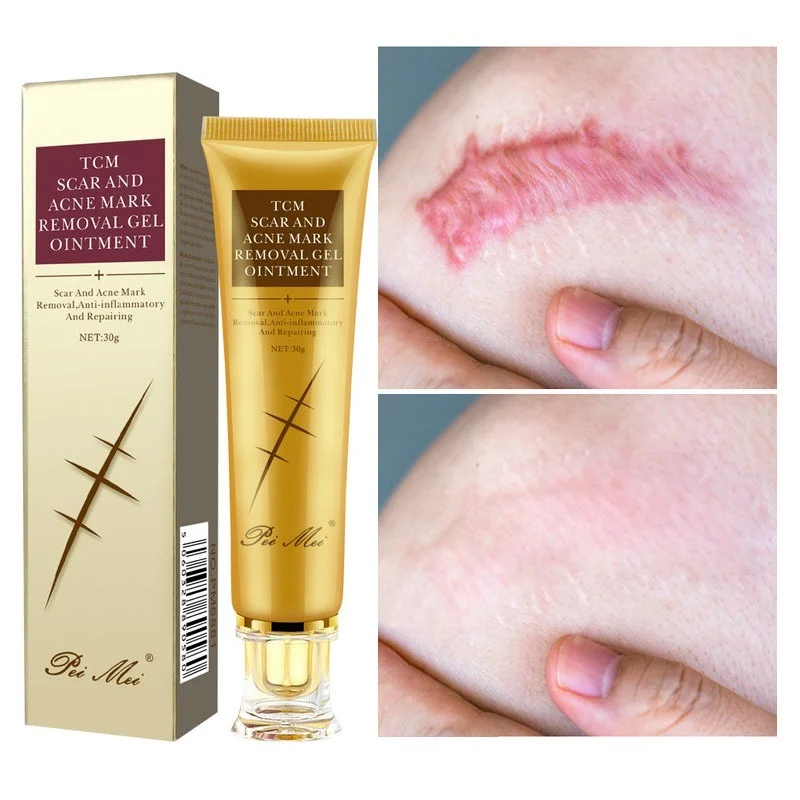 

30g Acne Scar Removal Cream Pimples Stretch Marks Face Gel Remove Acne Smoothing Whitening Moisturizing Body Skin Care