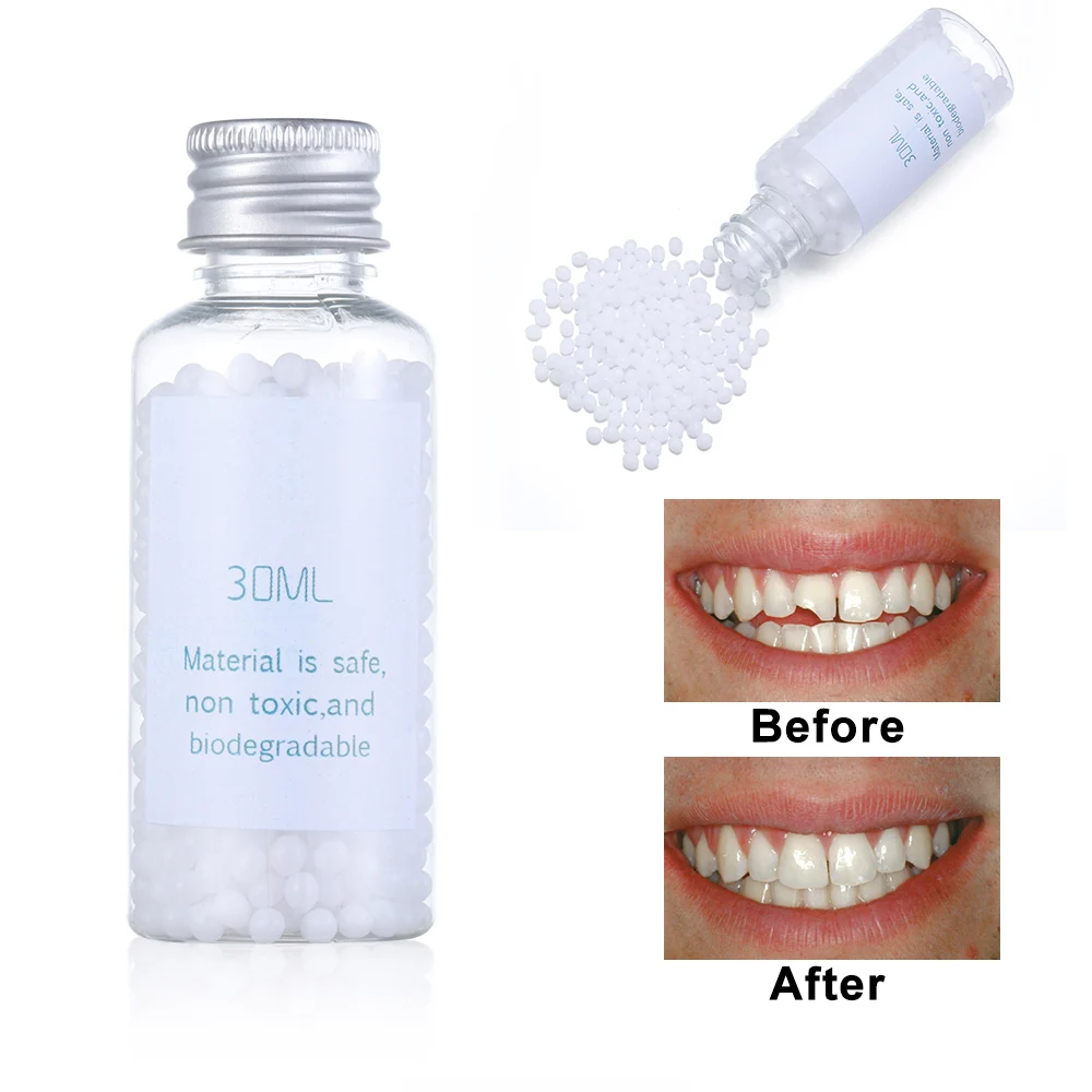 

1PC Solid Denture Adhesive Glue Oral Cavity Temporary Tooth Filling Material Replace Missing Repair DIY Kit Beauty Health Care