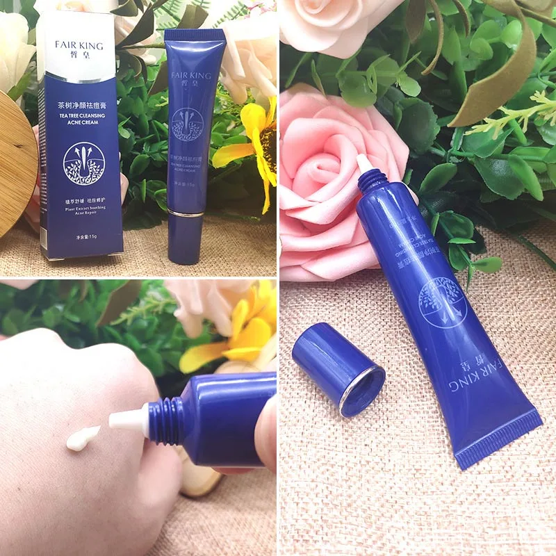 

Cystic Acne Spot Cream Fast Acting Formula Cream for Clearing Severe Acne from Face Body J9