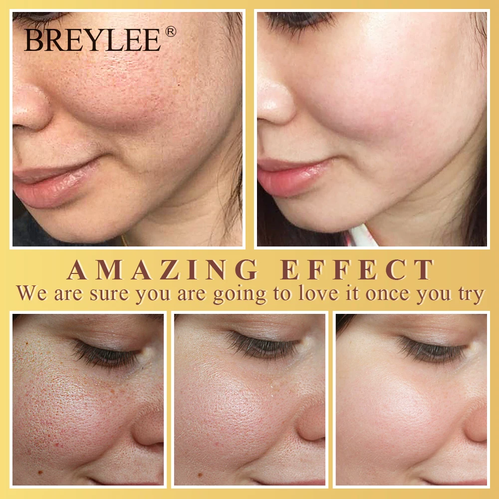 Крем для лица BREYLEE увлажняющий лосьон с маслом ши уход за кожей лечение акне