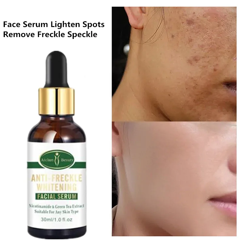 

Nicotinamide&Green Tea Whitening Face Serum Lighten Spots Brightening Facial Skin Essence Fade Dark Spots Remove Freckle Speckle